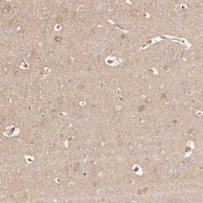 Immunohistochemistry-Paraffin: ERK2 Antibody [NBP1-87943]