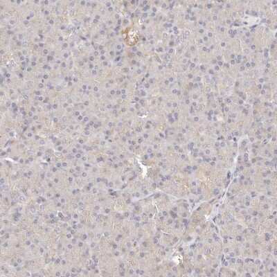 Immunohistochemistry-Paraffin: ERK2 Antibody [NBP1-87943]