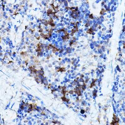 Immunohistochemistry-Paraffin: ERK2 Antibody - Azide and BSA Free [NBP3-02974]