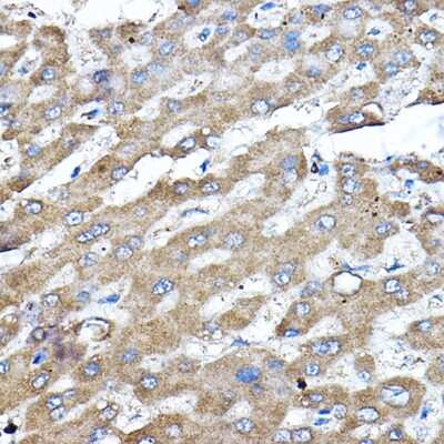 Immunohistochemistry-Paraffin: ERK2 Antibody - Azide and BSA Free [NBP3-02974]