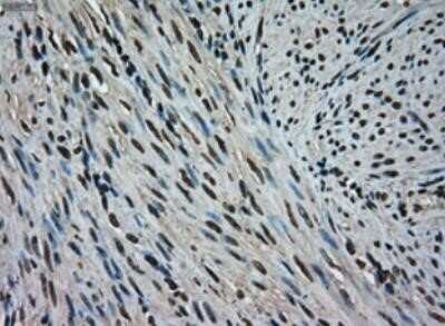 Immunohistochemistry: ERK2 Antibody (OTI6E5) - Azide and BSA Free [NBP2-71233]
