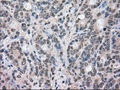 Immunohistochemistry: ERK2 Antibody (OTI6E5) - Azide and BSA Free [NBP2-71233]