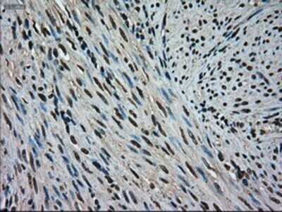 Immunohistochemistry: ERK2 Antibody (OTI6E5) - Azide and BSA Free [NBP2-71233]