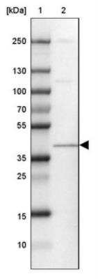 Western Blot: ERK2 Antibody [NBP1-87943]