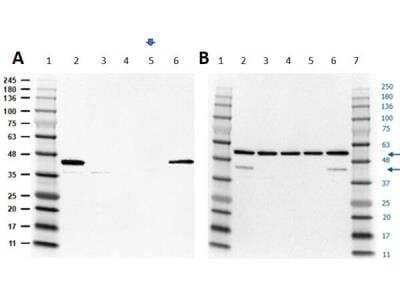 Western Blot: ERK2 Knockout A549 Cell Lysate [NBP3-18632]