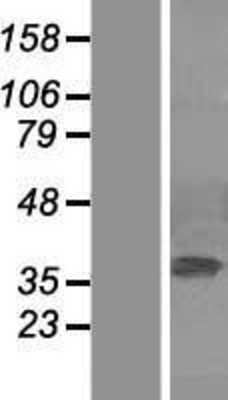 Western Blot: ERK2 Overexpression Lysate [NBL1-12865]