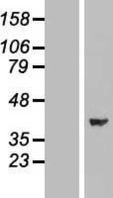 Western Blot: ERK2 Overexpression Lysate [NBL1-12866]