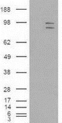 Western Blot: ERK3/MAPK6 Antibody (OTI5E1) [NBP1-47854]