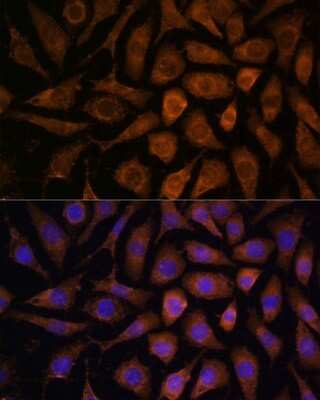 Immunocytochemistry/ Immunofluorescence: ERK3/MAPK6 Antibody - Azide and BSA Free [NBP3-03701]