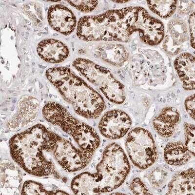 Immunohistochemistry-Paraffin: ERK3/MAPK6 Antibody [NBP1-84806]