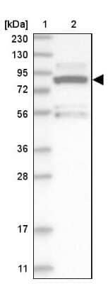 Western Blot: ERK3/MAPK6 Antibody [NBP1-84806]