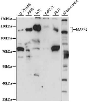 Western Blot: ERK3/MAPK6 AntibodyAzide and BSA Free [NBP3-03701]