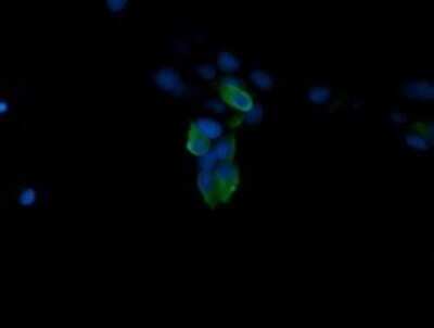 Immunocytochemistry/ Immunofluorescence: ERK4/MAPK4 Antibody (OTI2D7) - Azide and BSA Free [NBP2-71240]