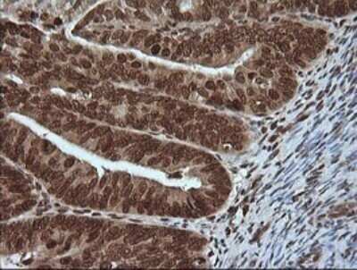 Immunohistochemistry: ERK4/MAPK4 Antibody (OTI2D7) - Azide and BSA Free [NBP2-71240]