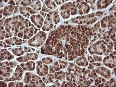 Immunohistochemistry: ERK4/MAPK4 Antibody (OTI2D7) - Azide and BSA Free [NBP2-71240]