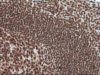 Immunohistochemistry: ERK4/MAPK4 Antibody (OTI2D7) - Azide and BSA Free [NBP2-71240]