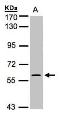 Western Blot: ERK4/MAPK4 Antibody [NBP1-31594]