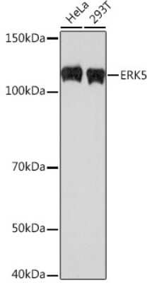 Western Blot: ERK5/BMK1 Antibody (5C1P5) [NBP3-16298]