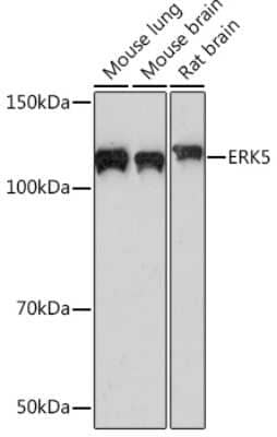 Western Blot: ERK5/BMK1 Antibody (5C1P5) [NBP3-16298]