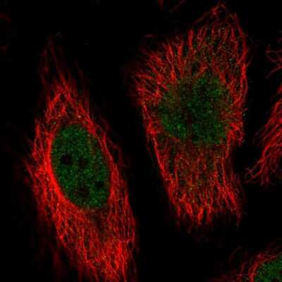 Immunocytochemistry/ Immunofluorescence: ERK5/BMK1 Antibody [NBP2-58369]