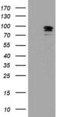 Western Blot: ERK5/BMK1 Antibody (OTI3H2)Azide and BSA Free [NBP2-71243]