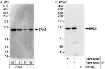 Western Blot: ERK5/BMK1 Antibody [NBP1-42673]