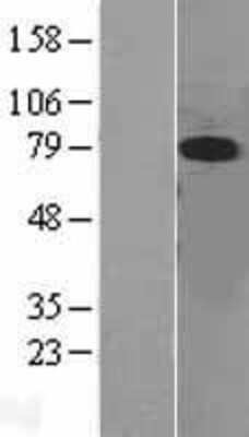 Western Blot: ERK5/BMK1 Overexpression Lysate [NBL1-12879]