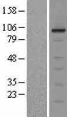 Western Blot: ERK5/BMK1 Overexpression Lysate [NBL1-12882]