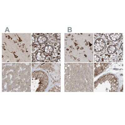 Immunohistochemistry-Paraffin: ERLEC1 Antibody [NBP1-86802]