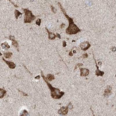 Immunohistochemistry-Paraffin: ERLEC1 Antibody [NBP1-86802]