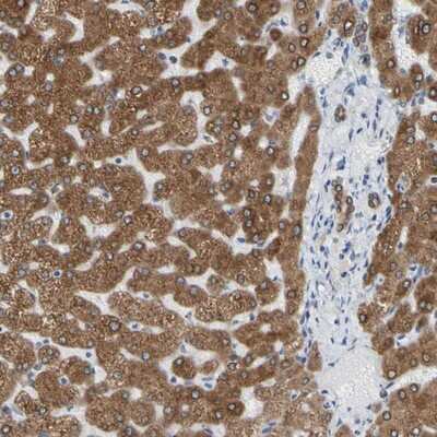 Immunohistochemistry-Paraffin: ERLIN1 Antibody [NBP1-88539]