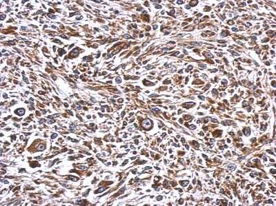 Immunohistochemistry-Paraffin: ERLIN1 Antibody [NBP2-16368]