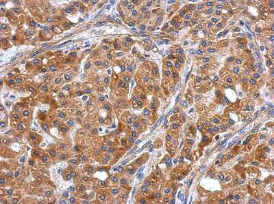 Immunohistochemistry-Paraffin: ERLIN1 Antibody [NBP2-16368]