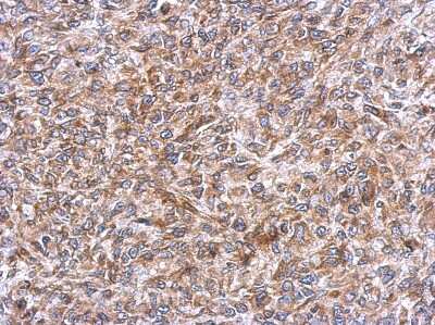 Immunohistochemistry-Paraffin: ERLIN1 Antibody [NBP2-16368]