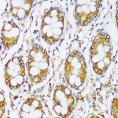 Immunohistochemistry-Paraffin: ERLIN1 Antibody - Azide and BSA Free [NBP3-04903]
