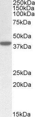 Western Blot: ERLIN1 Antibody [NBP1-45206]