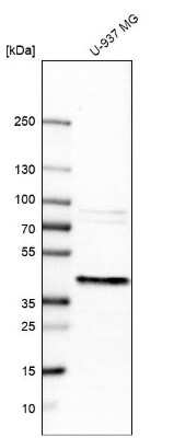 Western Blot: ERLIN1 Antibody [NBP1-88539]