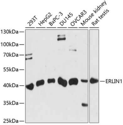 Western Blot: ERLIN1 AntibodyAzide and BSA Free [NBP3-04903]