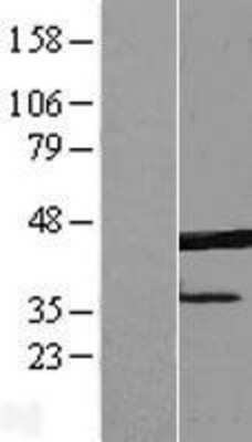 Western Blot: ERLIN1 Overexpression Lysate [NBL1-10333]