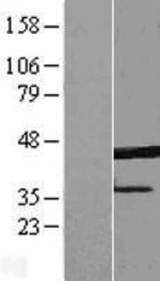 Western Blot: ERLIN1 Overexpression Lysate [NBP2-09332]