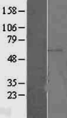 Western Blot: ETV5/ERM Overexpression Lysate [NBL1-10361]