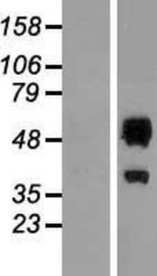 Western Blot: ERMAP Overexpression Lysate [NBP2-08678]