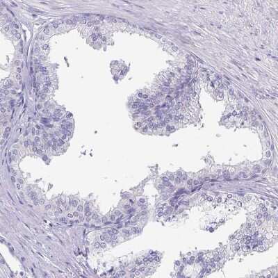Immunohistochemistry-Paraffin: ERMN Antibody [NBP1-84802]