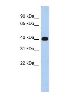 Western Blot: ERMN Antibody [NBP1-56953]