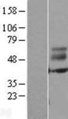 Western Blot: ERMN Overexpression Lysate [NBL1-10334]