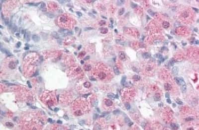 Immunohistochemistry-Paraffin: ERMP1 Antibody [NBP3-14316]