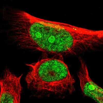 Immunocytochemistry/ Immunofluorescence: ERMP1 Antibody [NBP2-13970]