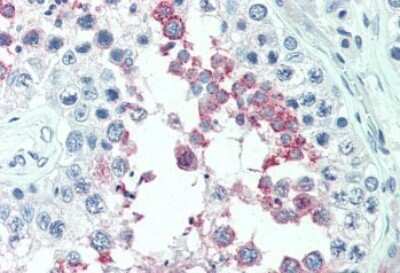 Immunohistochemistry-Paraffin: ERMP1 Antibody [NBP3-14315]