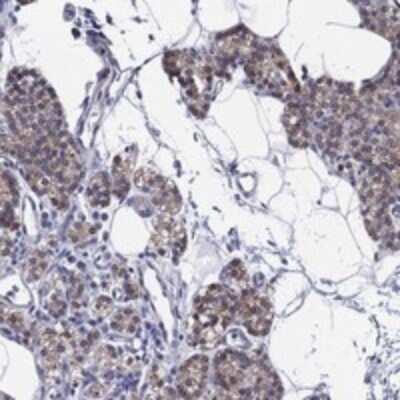 Immunohistochemistry-Paraffin: ERMP1 Antibody [NBP3-17585]