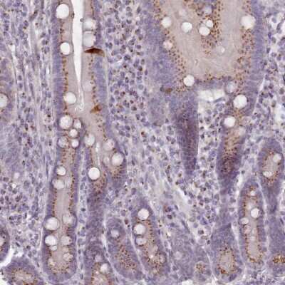 Immunohistochemistry-Paraffin: ERManI Antibody [NBP2-14216]